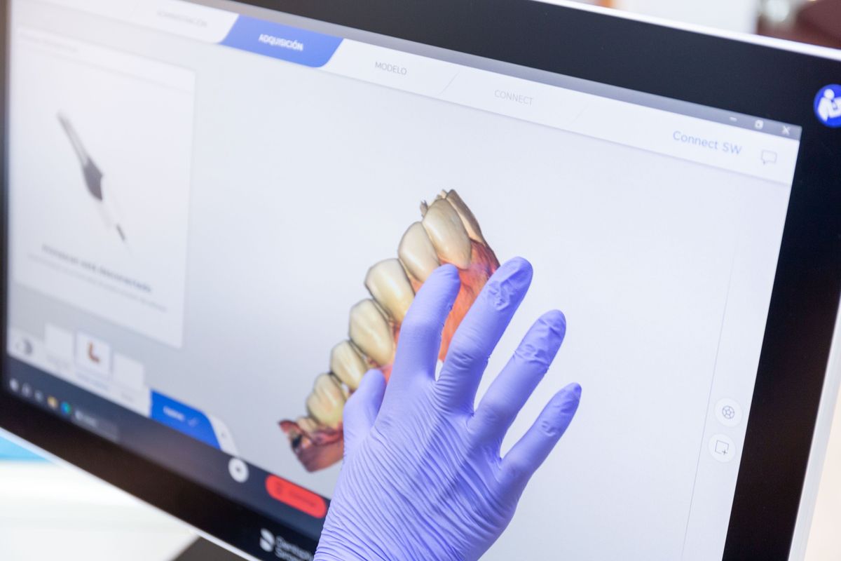 Modelo de dientes de cerámica
