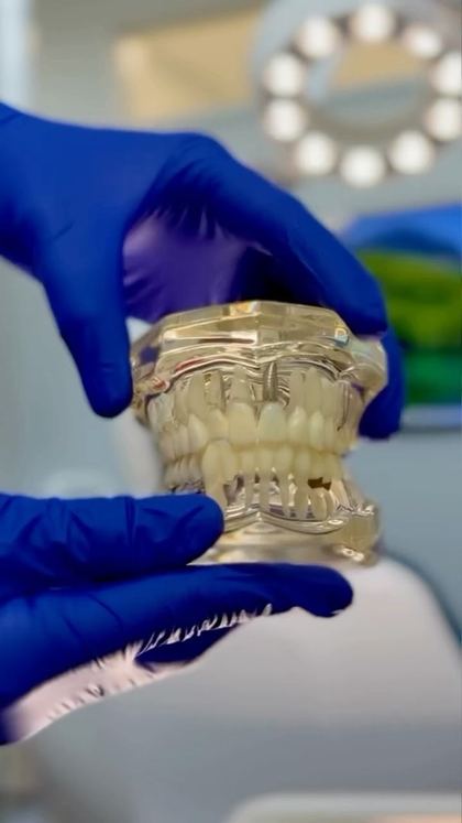 Modelo dental con brackets