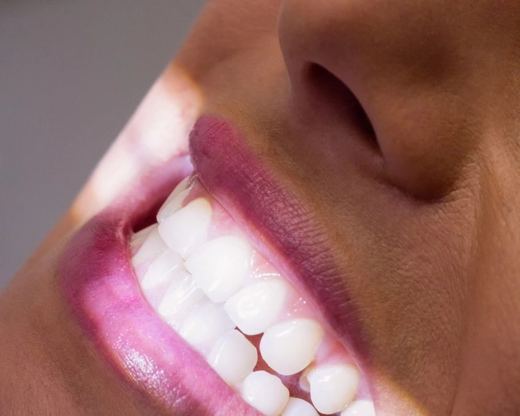 Sonrisa blanca en primer plano