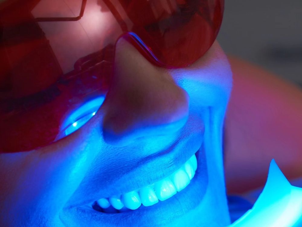 Sonrisa durante un blanqueamiento con luz