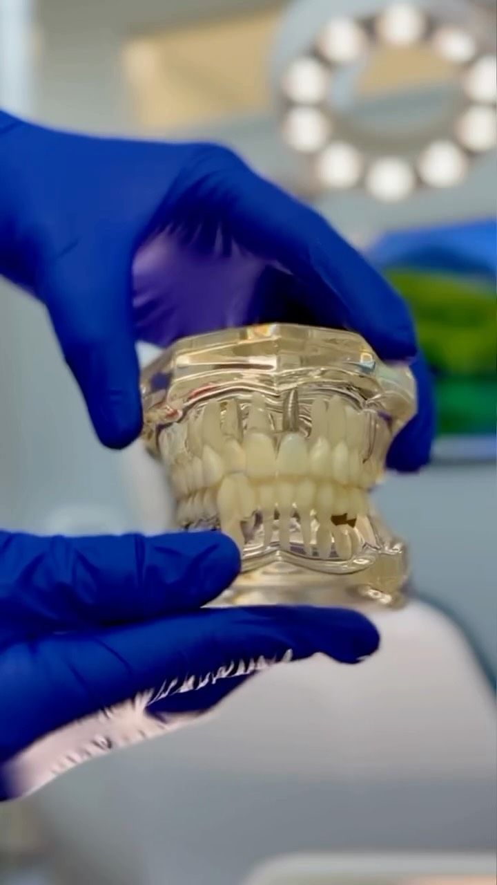 Modelo dental con brackets